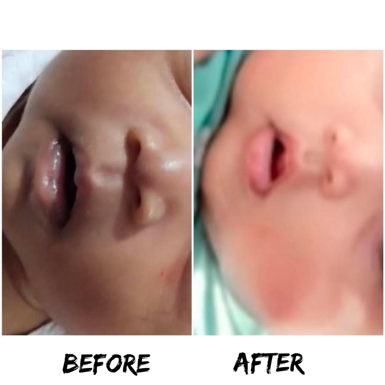 Transformation Result 6