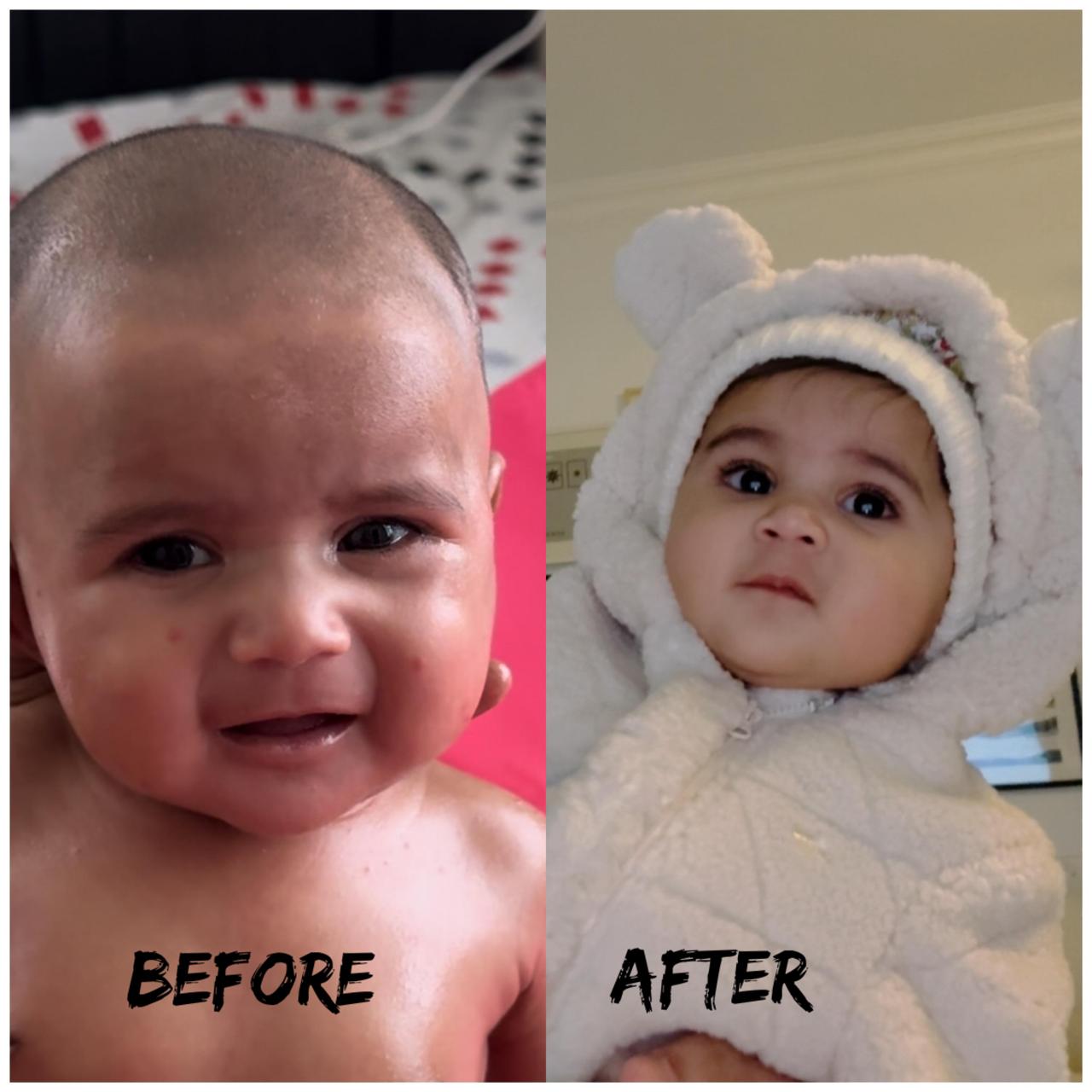 Transformation Result 8